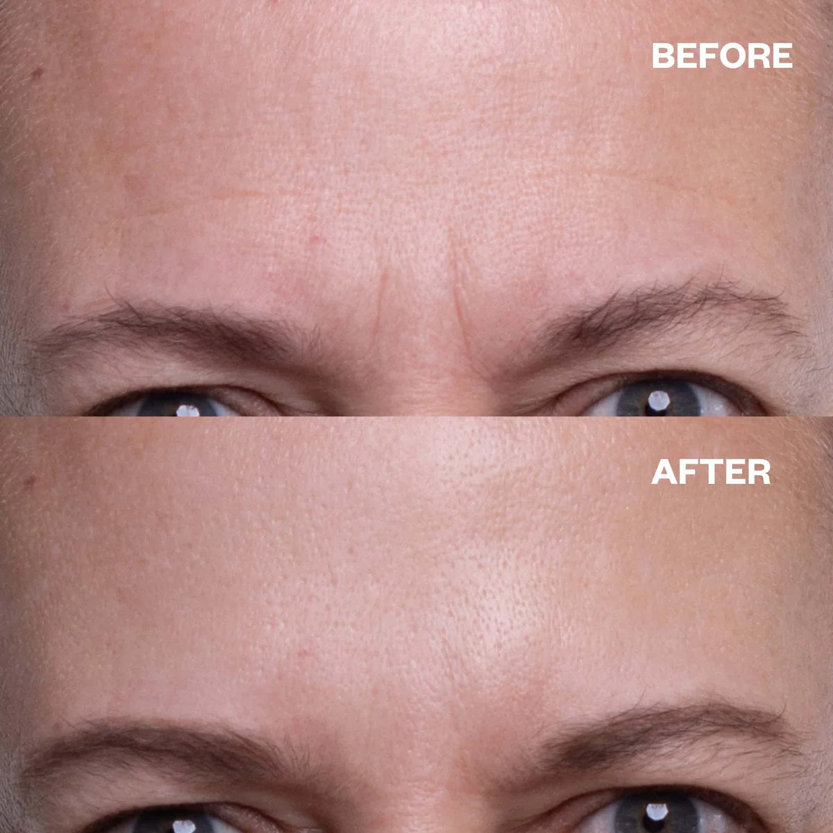 Anti-Wrinkle Forehead Patches - Reusable Silicone Smoothing Strips for Fine Lines & Wrinkles - Perfect for Overnight Use, Skincare Routine & Makeup Prep