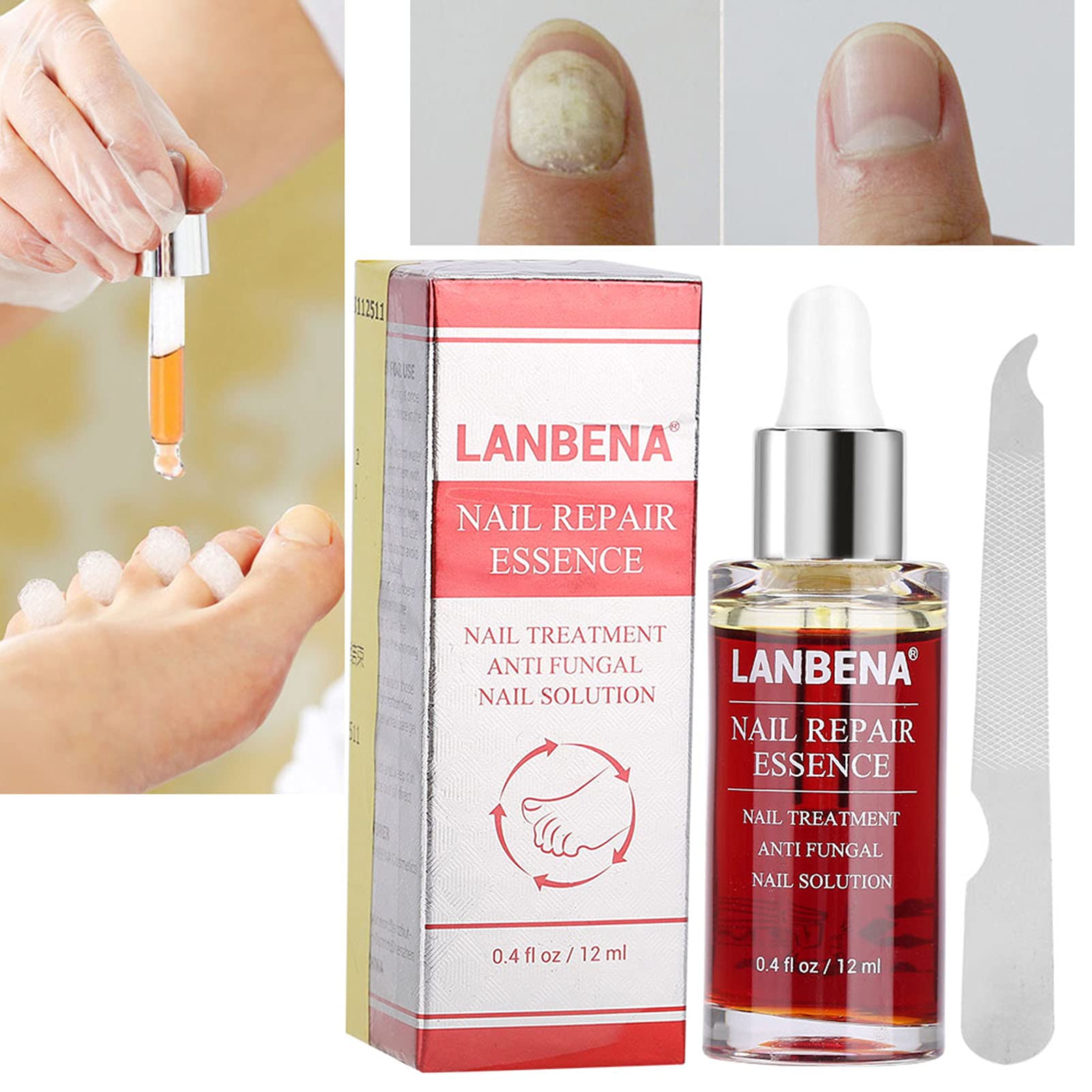 12ML Natural Nail Repair Essence - Powerful Anti-Fungus Treatment for Damaged & Discolored Nails | Effective Nail Care Solution for Toenails & Fingernails | Perfect for Salon Use & Home Manicures