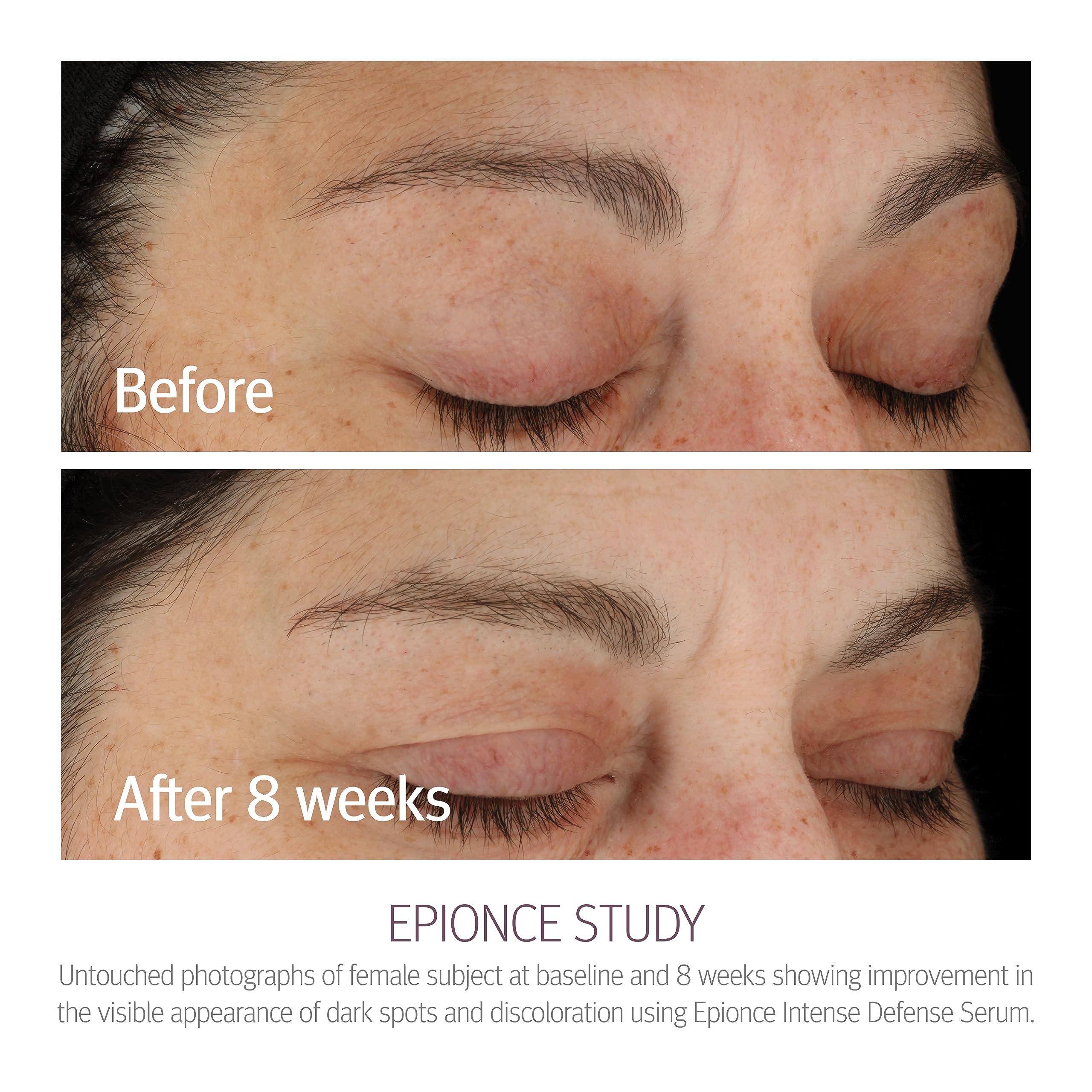 Epionce Intense Defense Serum - Anti-Aging Facial Serum with Vitamin C, E, D, A, B & Niacinamide | Dermatologist-Recommended Skincare for Wrinkles, Fine Lines & Dark Spots | Day & Night Use for Radiant Skin