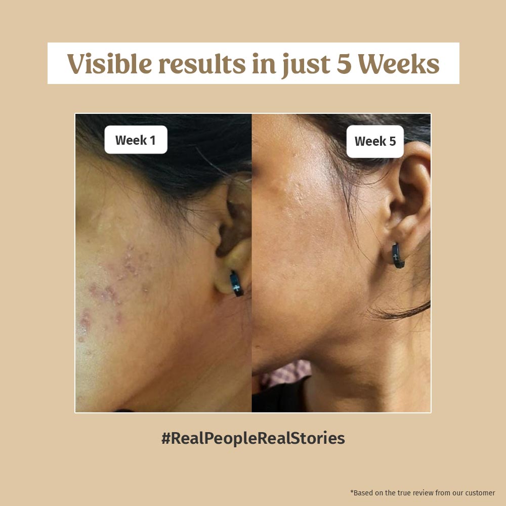 Best Skin Brightening Kit for Glowing Complexion - Brighten & Even Skin Tone - Perfect for Daily Skincare & Special Occasions