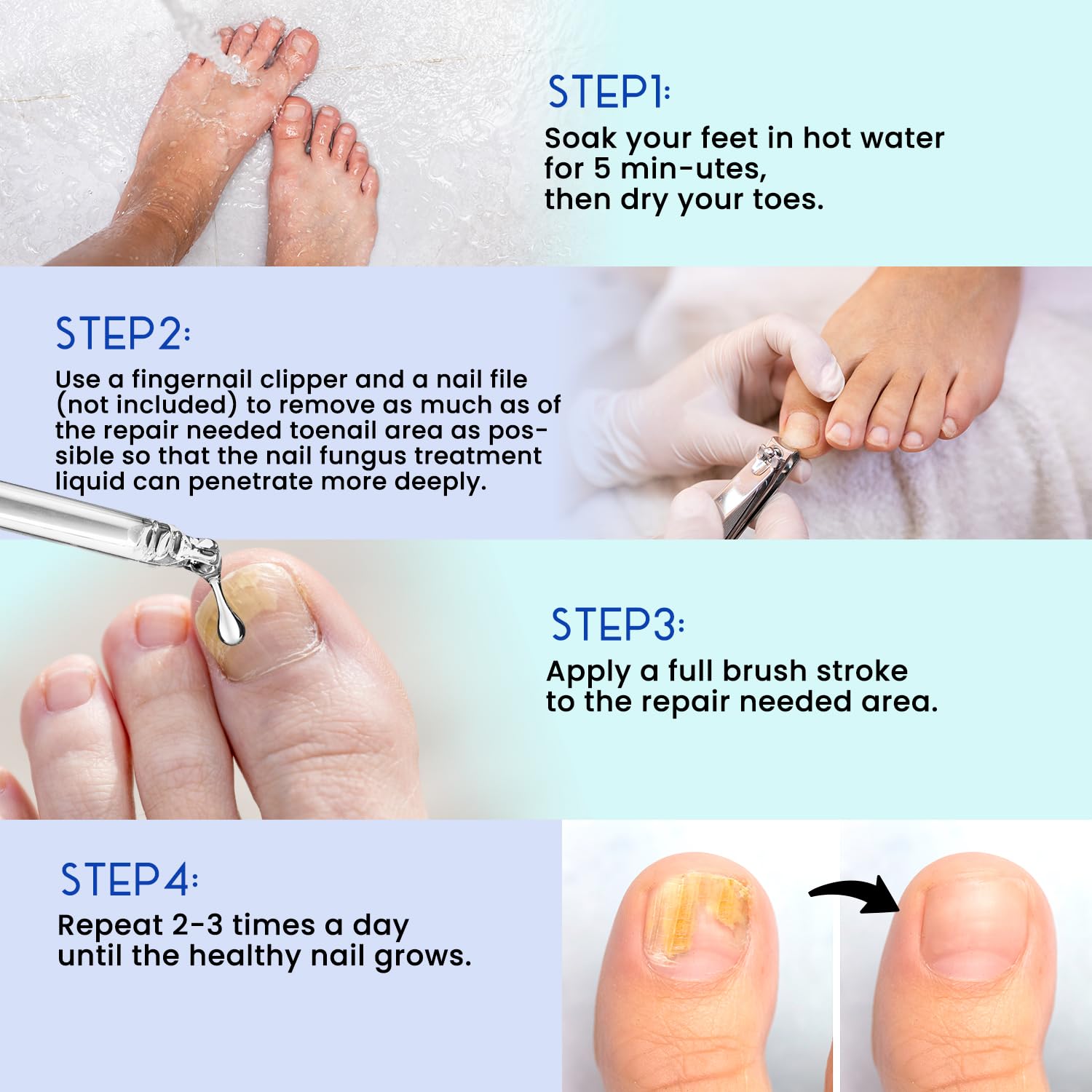 Extra Strength Toenail Repair Treatment for Thick, Broken, Discolored & Damaged Nails - 1oz Nail Renewal Solution - Perfect for Fungal Nail Care & Pedicure Prep at Home