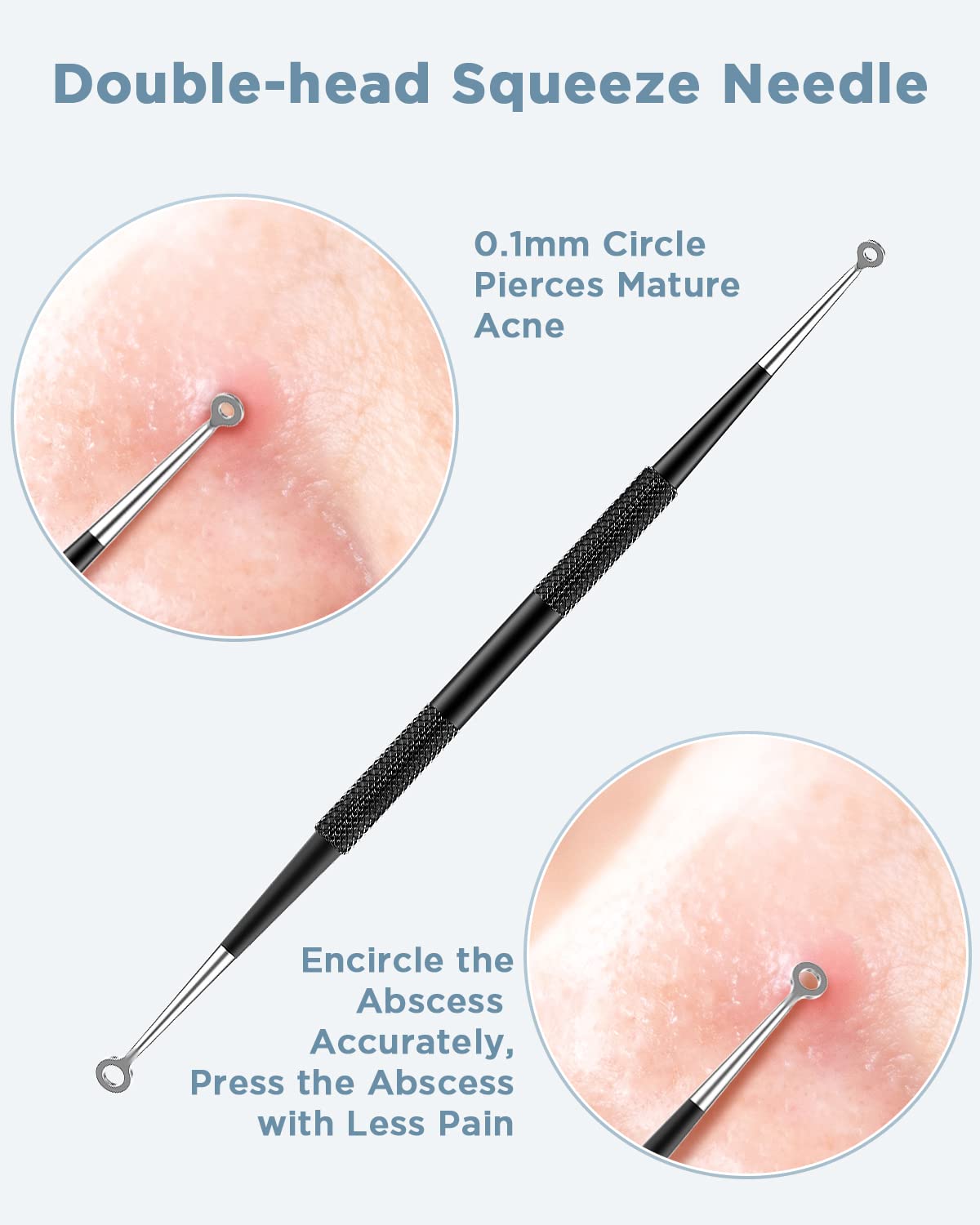 Professional Stainless Steel Blackhead Remover & Pimple Popper Kit - Acne Extractor Tool for Face, Comedones, Whitehead & Blemish Removal - Perfect for Home Skincare & Spa Treatments
