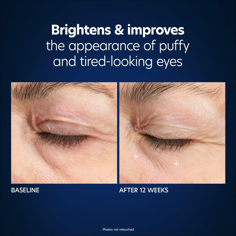 Hyaluronic Acid Microneedle Eye Patches for Dark Circles & Wrinkles - Under Eye Treatment for Puffiness & Fine Lines - Perfect for Night Routine & Travel Skincare
