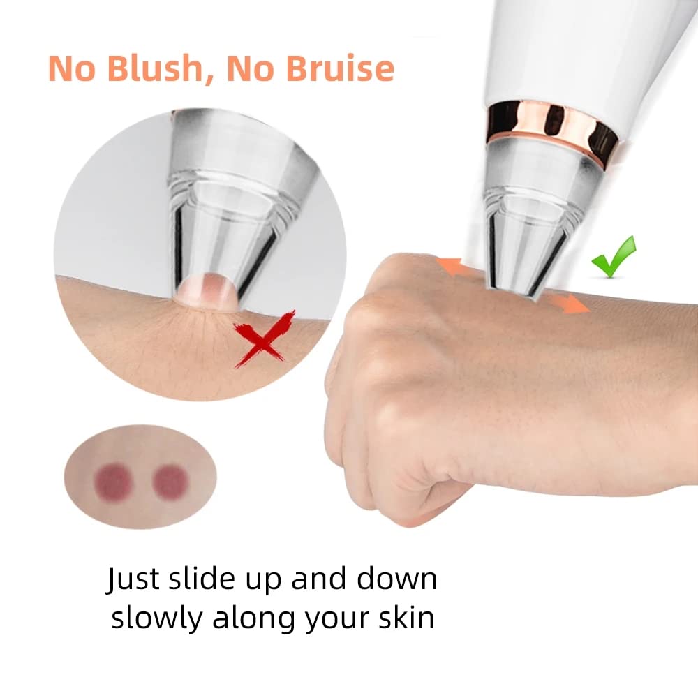 ATOMUS Electric Blackhead Remover Vacuum Tool - Professional Facial Pore Cleaner for Acne & Black Spots Removal - Skin Care Deep Cleaning Machine Kit for Home Spa & Beauty Routine