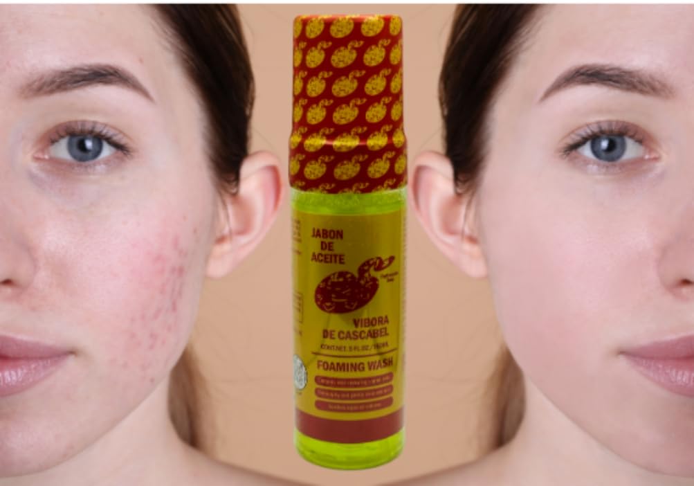 Rattlesnake Oil Soap (140g) & Foaming Face & Body Wash (150ml) - Original Formula for Skin Imperfections - Acne Treatment, Deep Cleansing, Moisturizing - Perfect for Daily Skincare Routine