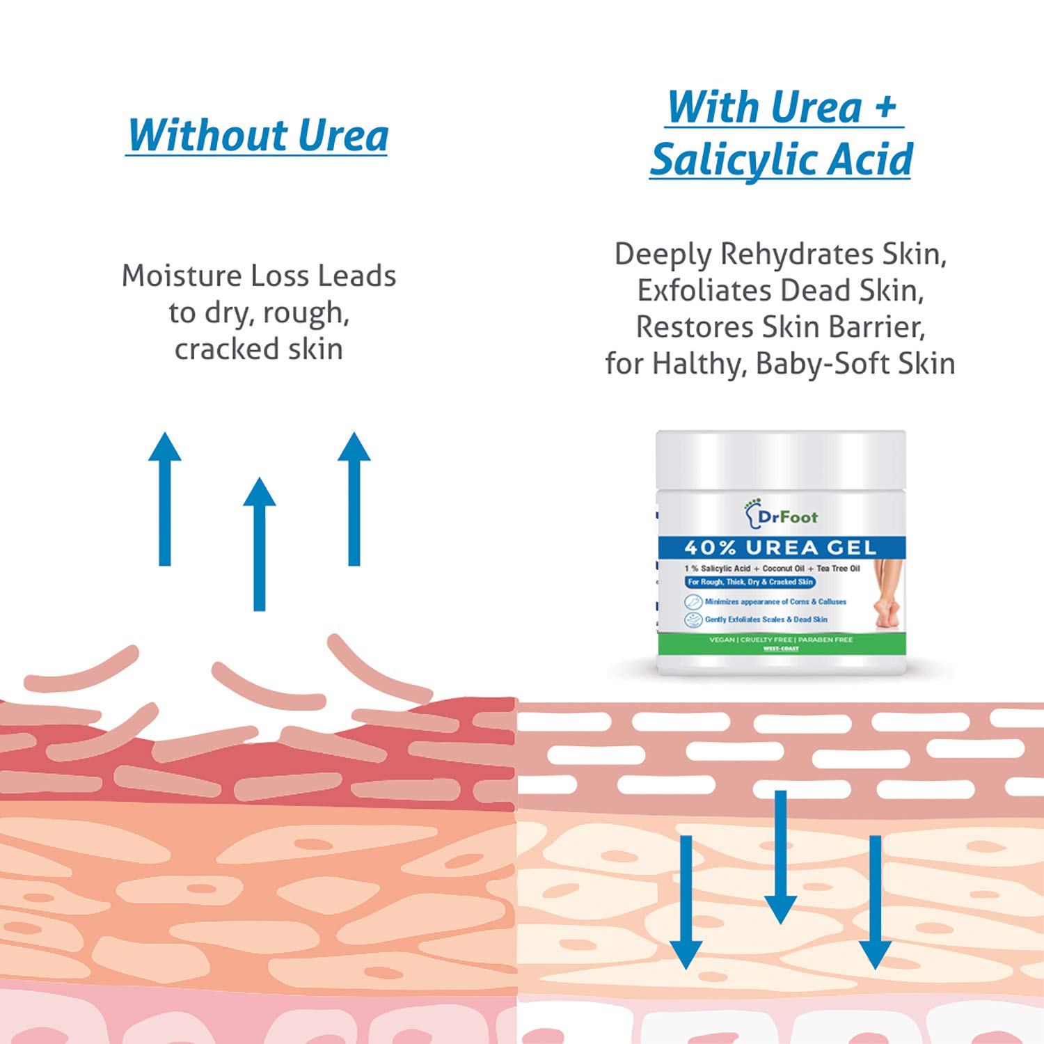 Dr Foot Cracked Heel Repair Cream - 40% Urea & 1% Salicylic Acid Foot Care Treatment for Dry, Rough Feet - Dead Skin Remover Gel for Cracked Heels & Calluses - Perfect for Daily Foot Care Routine, Pedicures & Winter Foot Protection