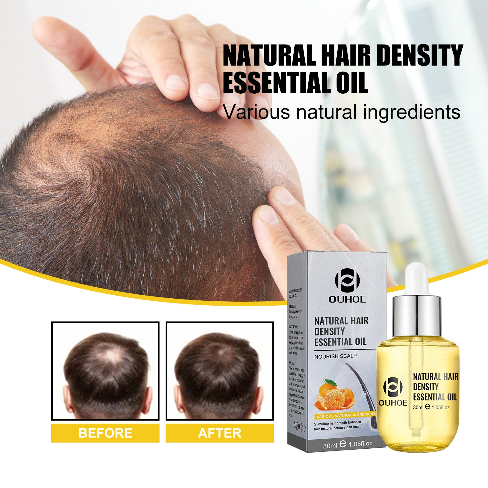 Best Hair Care Essential Oil for Moisturizing & Thickening - Natural Scalp Treatment for Dry Damaged Hair - Perfect for Daily Use & Salon Treatments