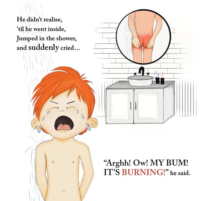 Willy and His Sunburnt Bum - Funny Kids Adventure Book for Summer Reading & Beach Trips