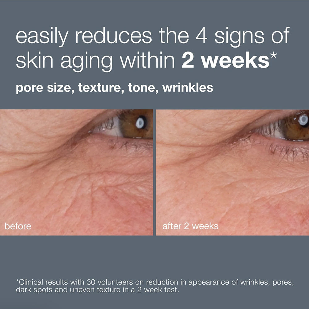Dermalogica Dynamic Skin Retinol Serum - Anti-Aging Face Serum for Wrinkles & Fine Lines - Best Retinol Treatment for Smooth, Youthful Skin - Perfect for Nighttime Skincare Routine & Daily Use
