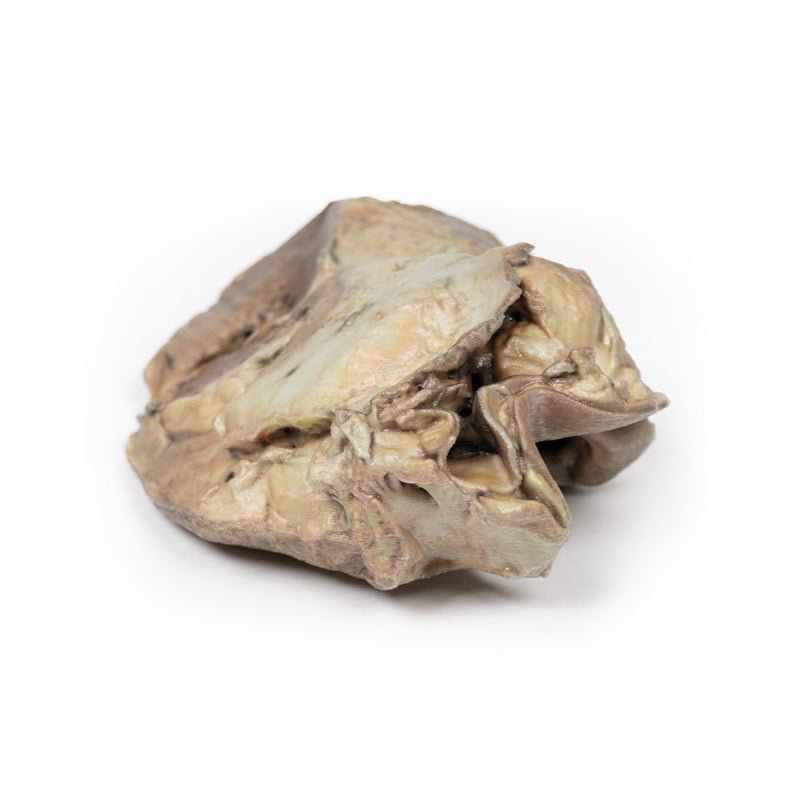 3D Printed Biscupid Aortic Valve - High Precision Medical Heart Valve Replacement for Cardiovascular Surgery - Ideal for Surgeons, Hospitals & Medical Training
