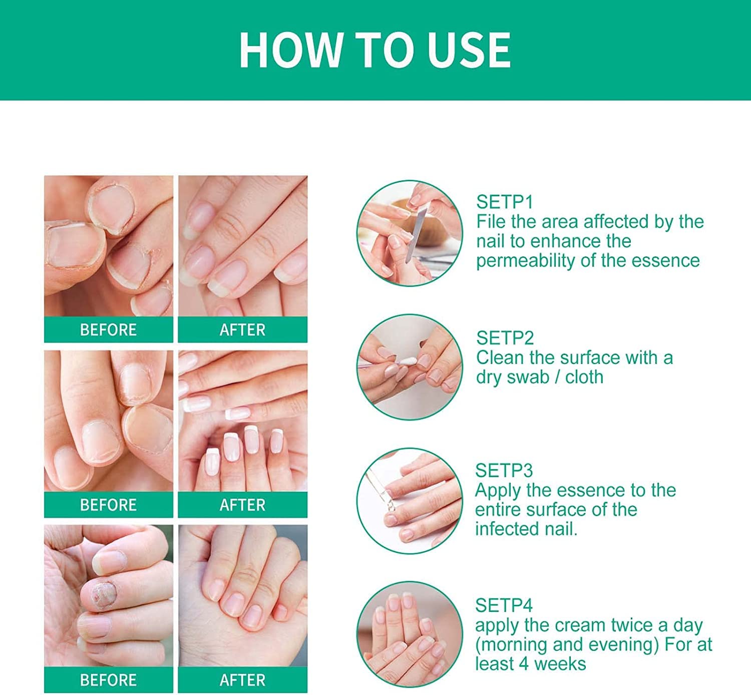 Kerassentials Toenail Fungus Treatment Oil - Healthy Skin & Nail Care Solution (3 Pack) - Effective for Athlete's Foot, Nail Fungus & Dry Skin - Perfect for Daily Foot Care Routine