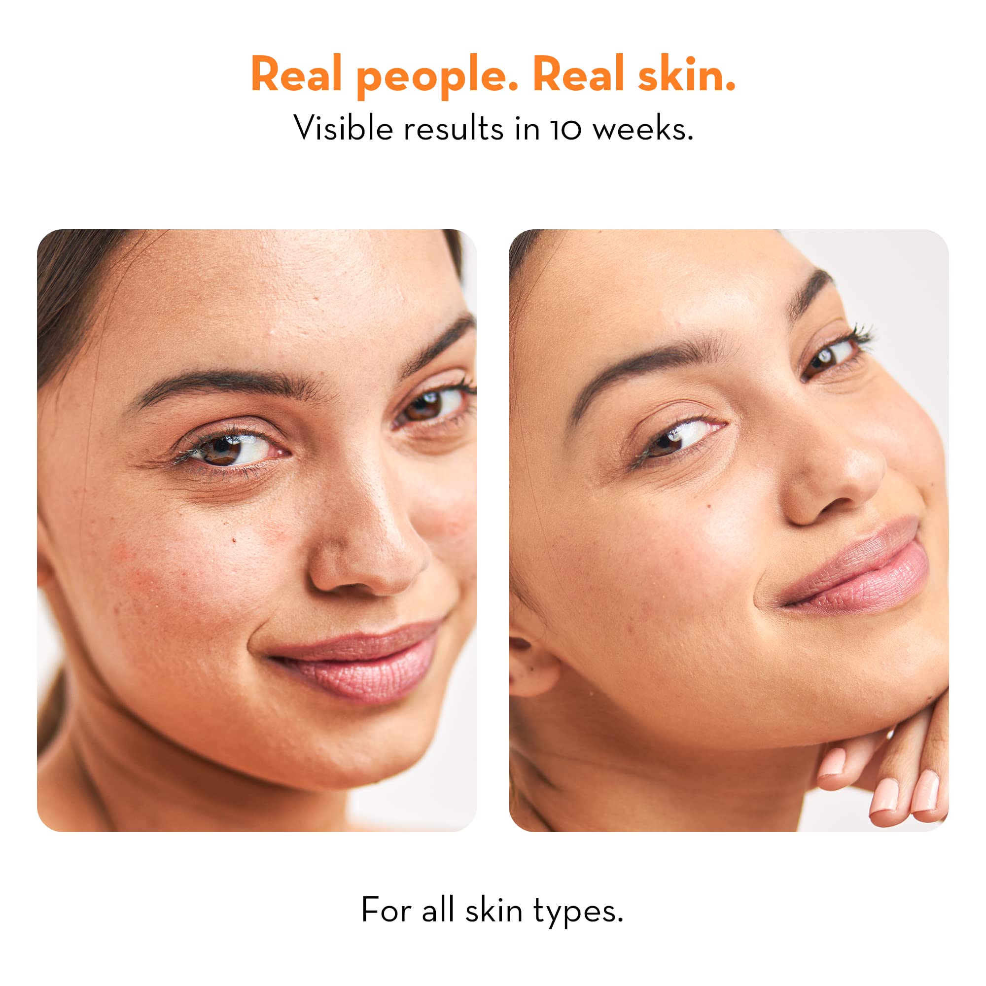 Niacinamide & Vitamin C Collagen Plush High Gentle Face Wash with Natural Exfoliating Beads - Fights Pigmentation, Dark Spots & Anti-Aging | Suitable for All Skin Types | 100ml | Perfect for Daily Skincare Routine & Sensitive Skin Care