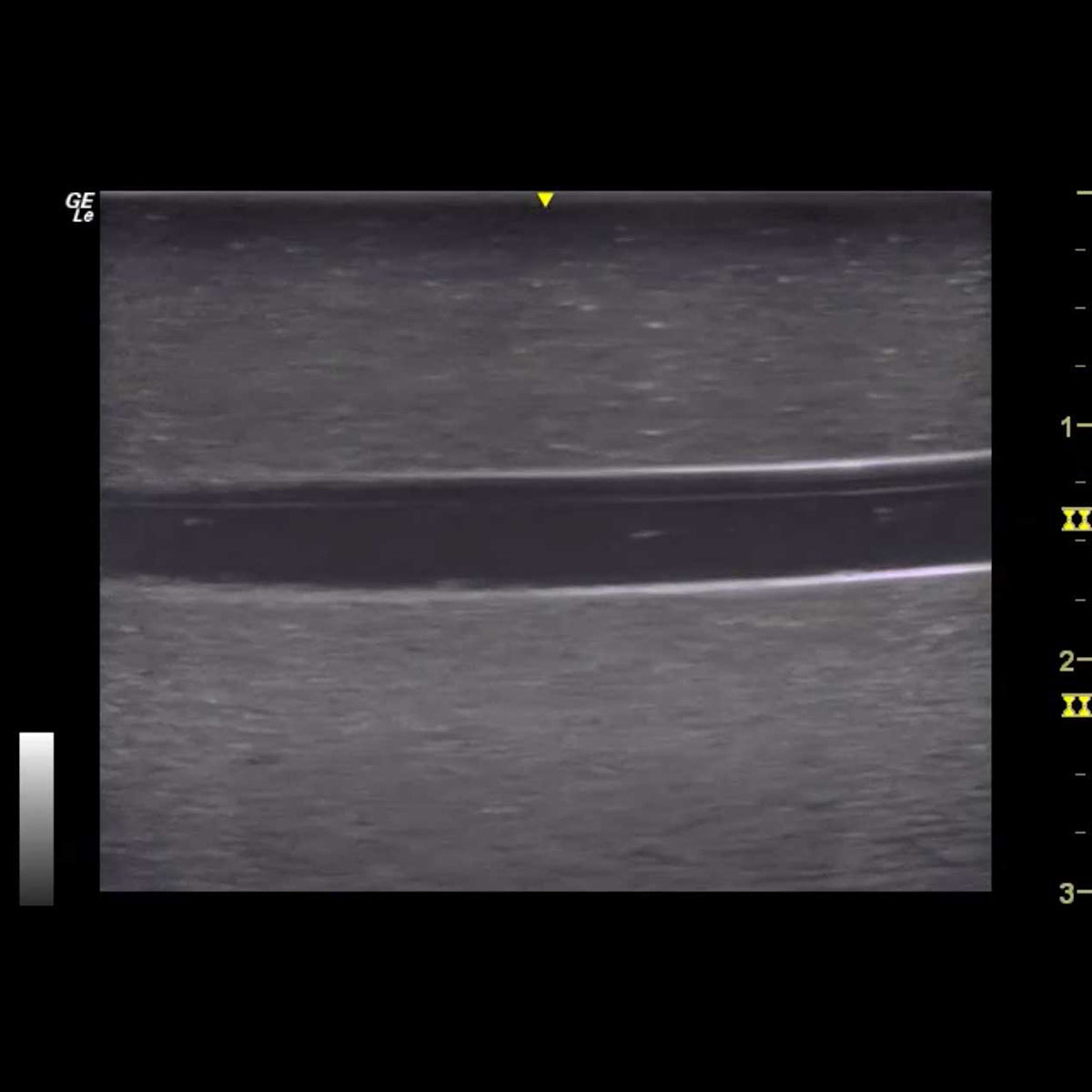 HM2.0 Remoldable 2-Vessel Ultrasound Training Model - Perfect for Medical Students & Sonography Practice (Arterial & Venous Vessel Simulation)