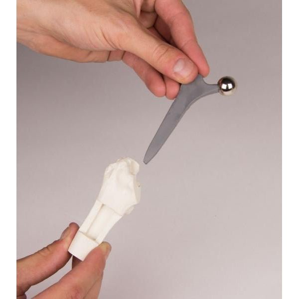 High-Quality Hip Implant Model - Medical Training & Surgical Demonstration Tool for Orthopedic Surgeons & Students