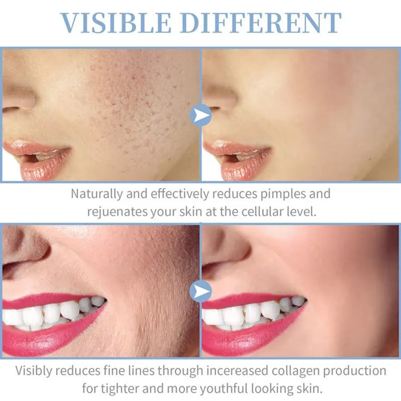 Professional High Frequency Facial Wand for Skin Rejuvenation - Anti-Aging, Acne Treatment & Skin Tightening - At-Home Spa & Salon Quality Skincare Device for Glowing Complexion