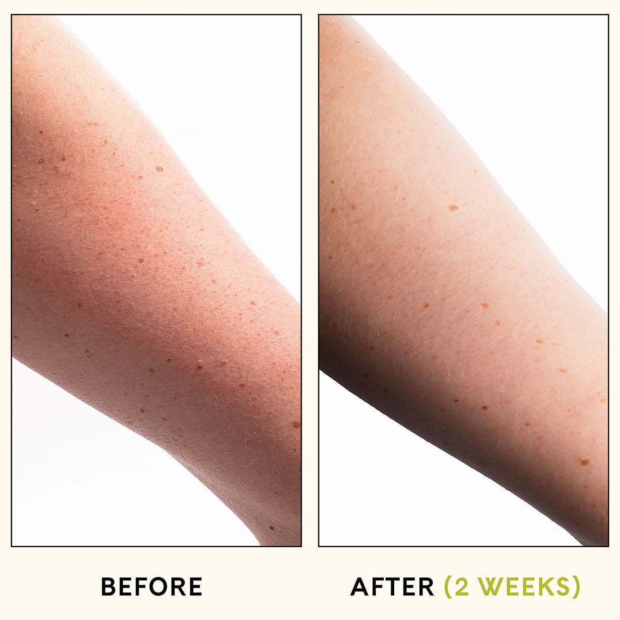 Exfoliating Fur KP Body Scrub for Keratosis Pilaris - Smooth & Glowing Skin - Perfect for Dry, Bumpy Skin Care Routine & Spa Days at Home