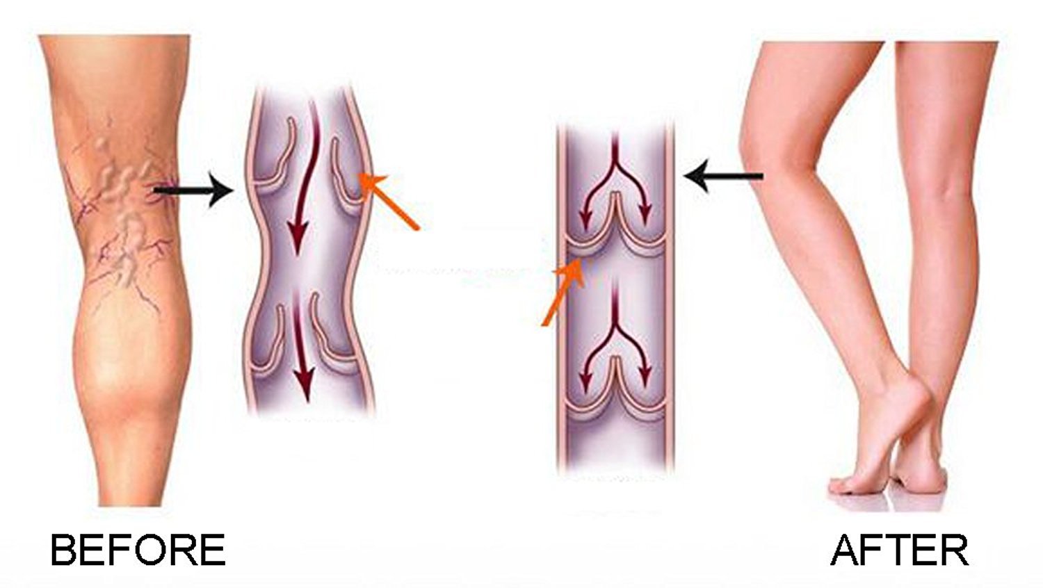 Women's 15-20mmHg Medical Compression Socks - Calf Support Stockings for Varicose Veins, Swelling & Circulation - Perfect for Nurses, Travel & Pregnancy