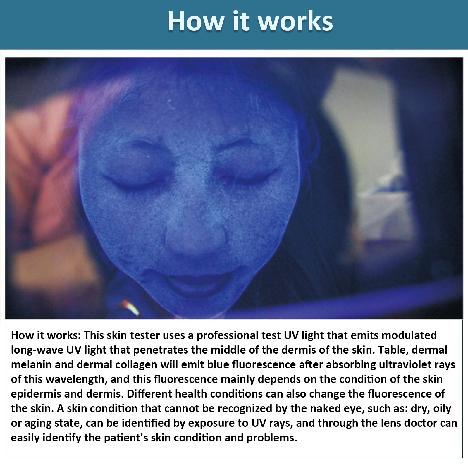 Elitzia ETD1029 Professional UV Skin Analyzer for Laptop - Portable Beauty Device for Skin Analysis & Care | Perfect for Home Spa, Dermatology Clinics & Beauty Salons