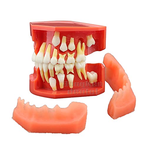 Dental Typodont Tooth Model - Primary Teeth Replacement for Dental Training & Pathology Display (M4006) | Perfect for Dental Students, Educators & Clinical Demonstrations