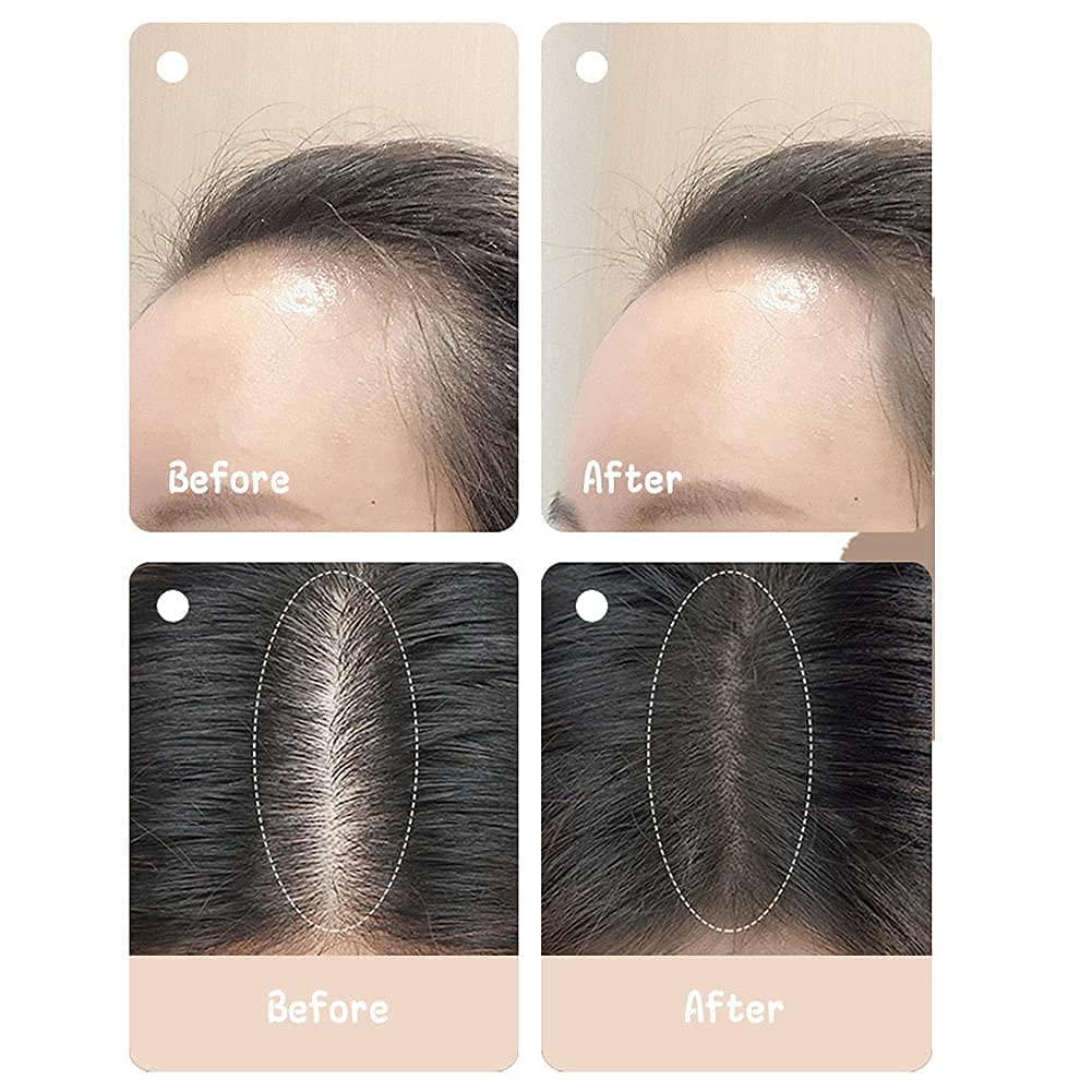 VBA Hair Shadow Powder & Hairline Powder Stick - Thinning Hair Concealer for Hair Loss, Root Touch-Up Powder to Cover Bald Spots & Hair Fall (Black, 178g) - Perfect for Daily Use, Travel & Quick Hairline Fixes