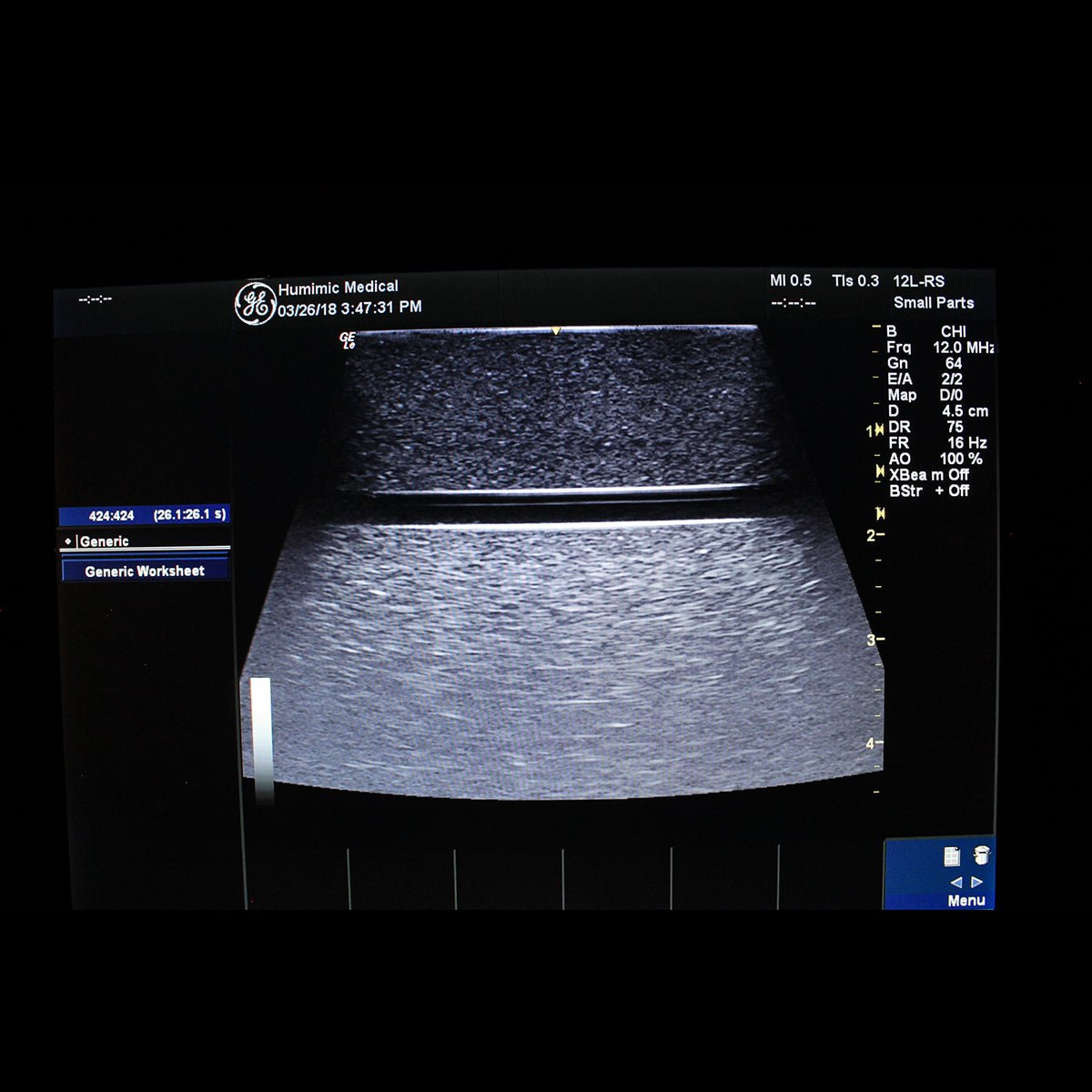 HM VH300 3 Vessel Ultrasound Phantom Trainer - High-Quality Medical Training Device for Sonography Practice, Vascular Imaging & Diagnostic Skills Development | Perfect for Ultrasound Tech Students, Radiology Labs & Clinical Education