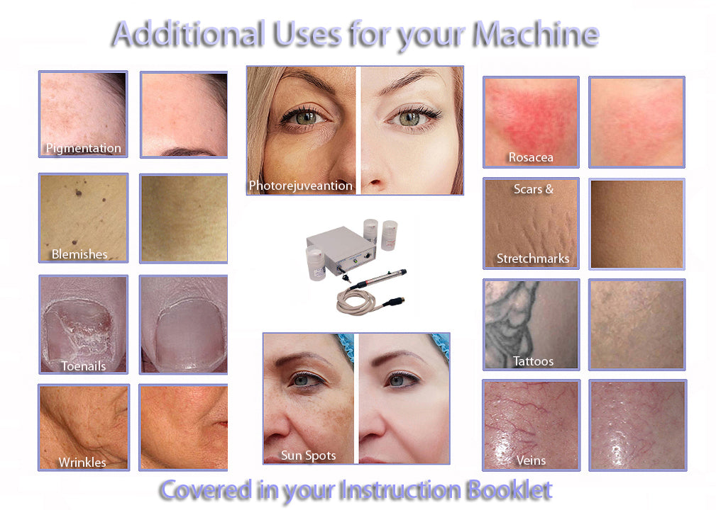 DM6050 DX Professional Hair Removal Device for Medispas & Salons - Best for Epilation Clinics, Permanent Hair Reduction at Home or Spa