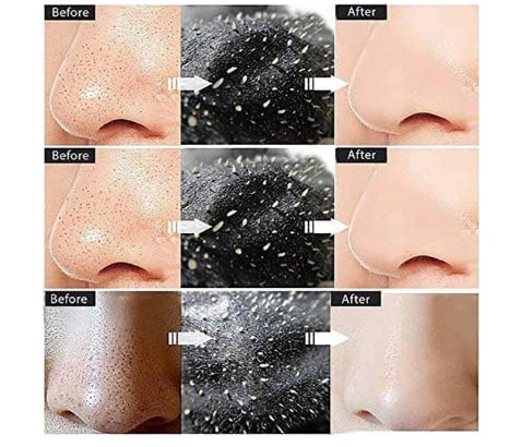First Beauty Activated Charcoal Peel Off Mask - Deep Cleansing, Anti-Blackhead, Pore Purifying Face Mask for Acne & Oily Skin - Pack of 1 - Perfect for Spa Night & Self-Care Routine