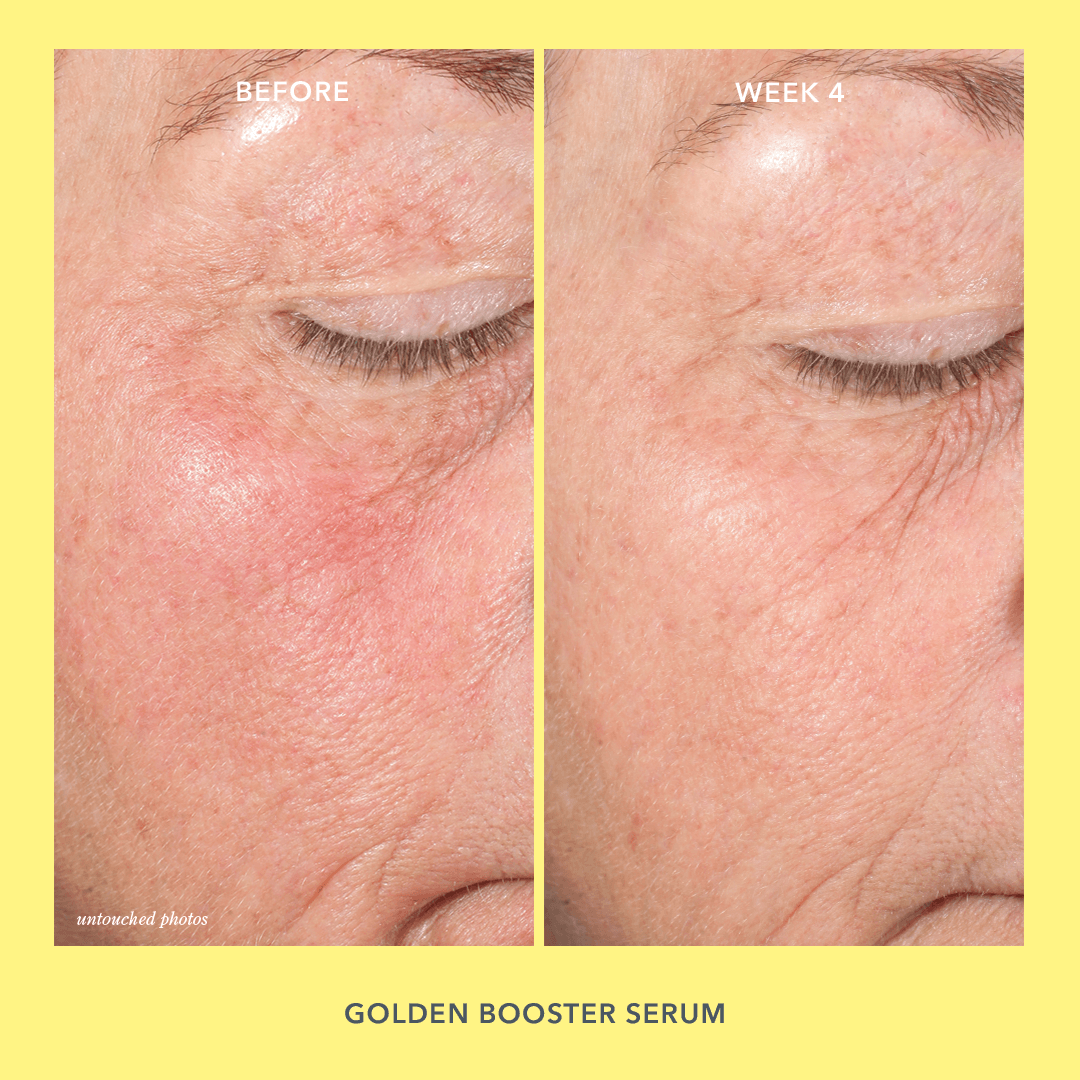 Golden Booster Amla Berry Vitamin C Brightening Serum for Face - Antioxidant Skin Care Treatment for Dark Spots & Dullness | Perfect for Daily Glow Routine & Nighttime Skin Repair