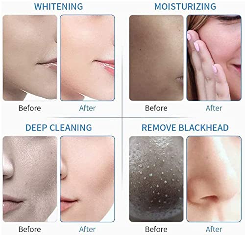 BELLA FACCIA 7-in-1 Hydrafacial Machine - Professional Hydrodermabrasion & Microdermabrasion Device for Deep Pore Cleansing & Skin Rejuvenation | Perfect for Spa, Salon & At-Home Skincare Treatments