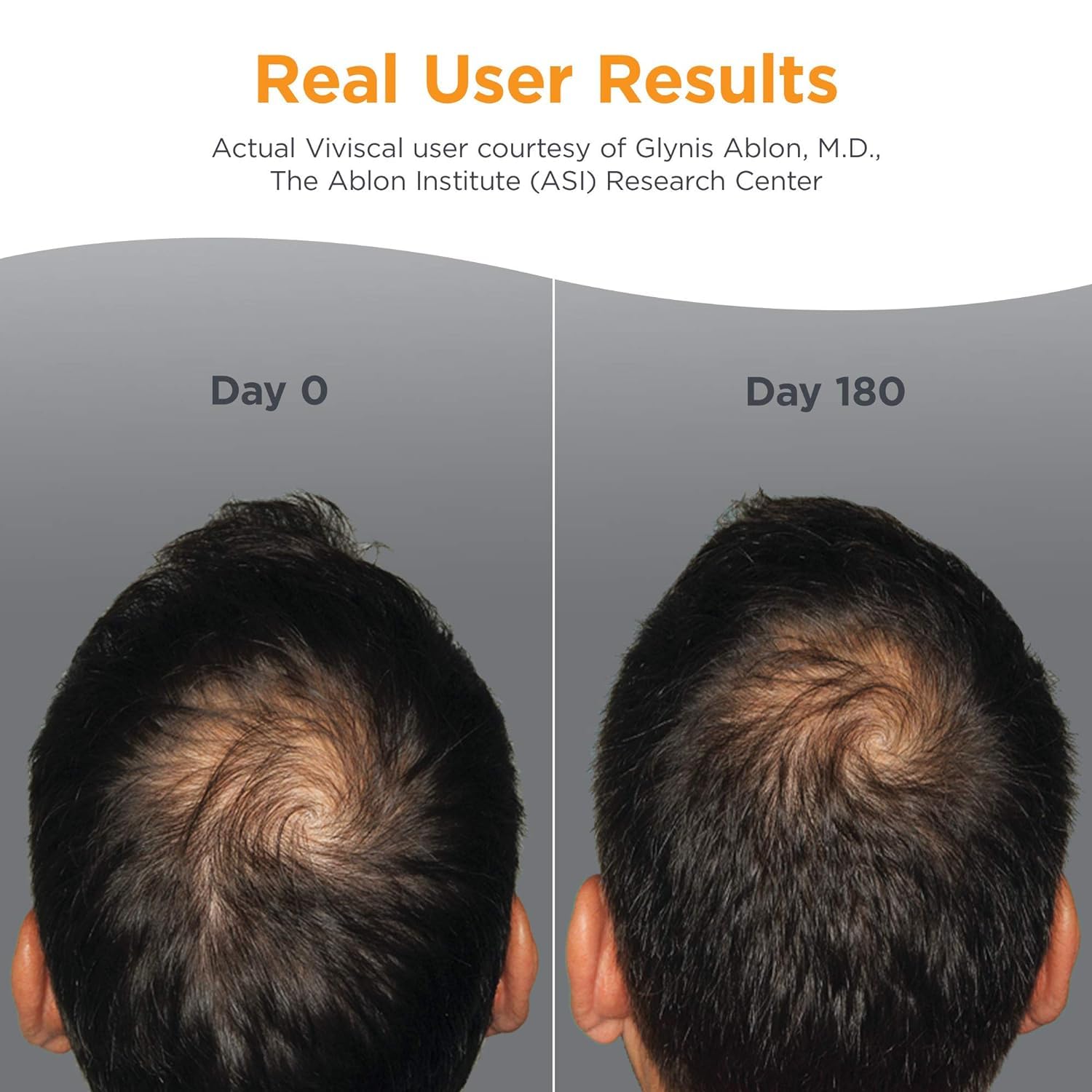 Viviscal Men's Hair Growth Supplements - Clinically Proven Formula with Proprietary Collagen Complex for Thicker, Fuller Hair (180 Tablets, 3 Month Supply) - Ideal for Thinning Hair & Hair Loss Prevention