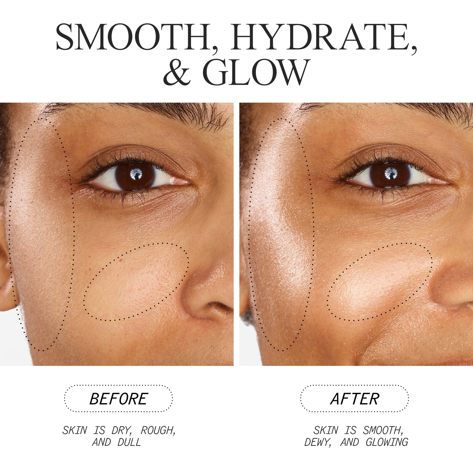 Skin Biome Hydration & Repair Cream - Moisturizing Face & Body Lotion for Dry Skin Relief - Perfect for Daily Skincare Routine & Post-Workout Recovery