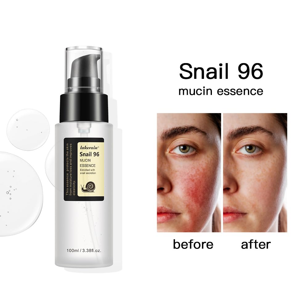 100ML Snail Mucin Serum for Face - Advanced Snail 96 Mucin Power Essence with Hyaluronic Acid | Dark Spot Repair, Hydration & Moisture Boost | Improve Skin Vitality & Elasticity | Perfect for Dry, Sensitive & Aging Skin Care Routine