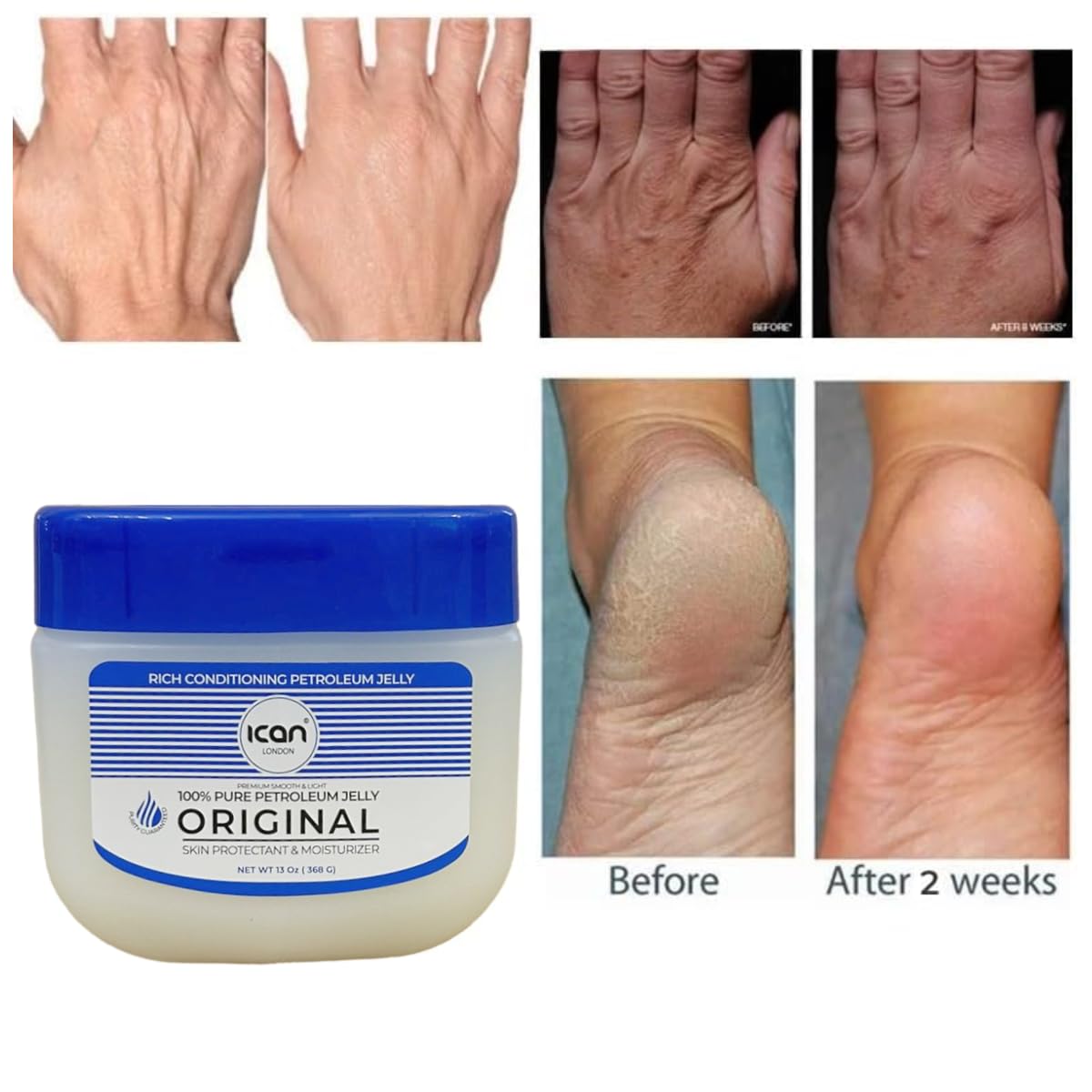 ICAN LONDON 100% Pure Petroleum Jelly Original 368g (13oz) - Multipurpose Skin Protectant for Dry Lips, Hands & Face | First Aid Ointment for Cuts & Burns