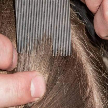 Zhunmun Stainless Steel Lice Comb for Head Lice Removal - Fine Metal Teeth Nit & Egg Comb for Kids & Adults - Perfect for School, Home & Travel Use