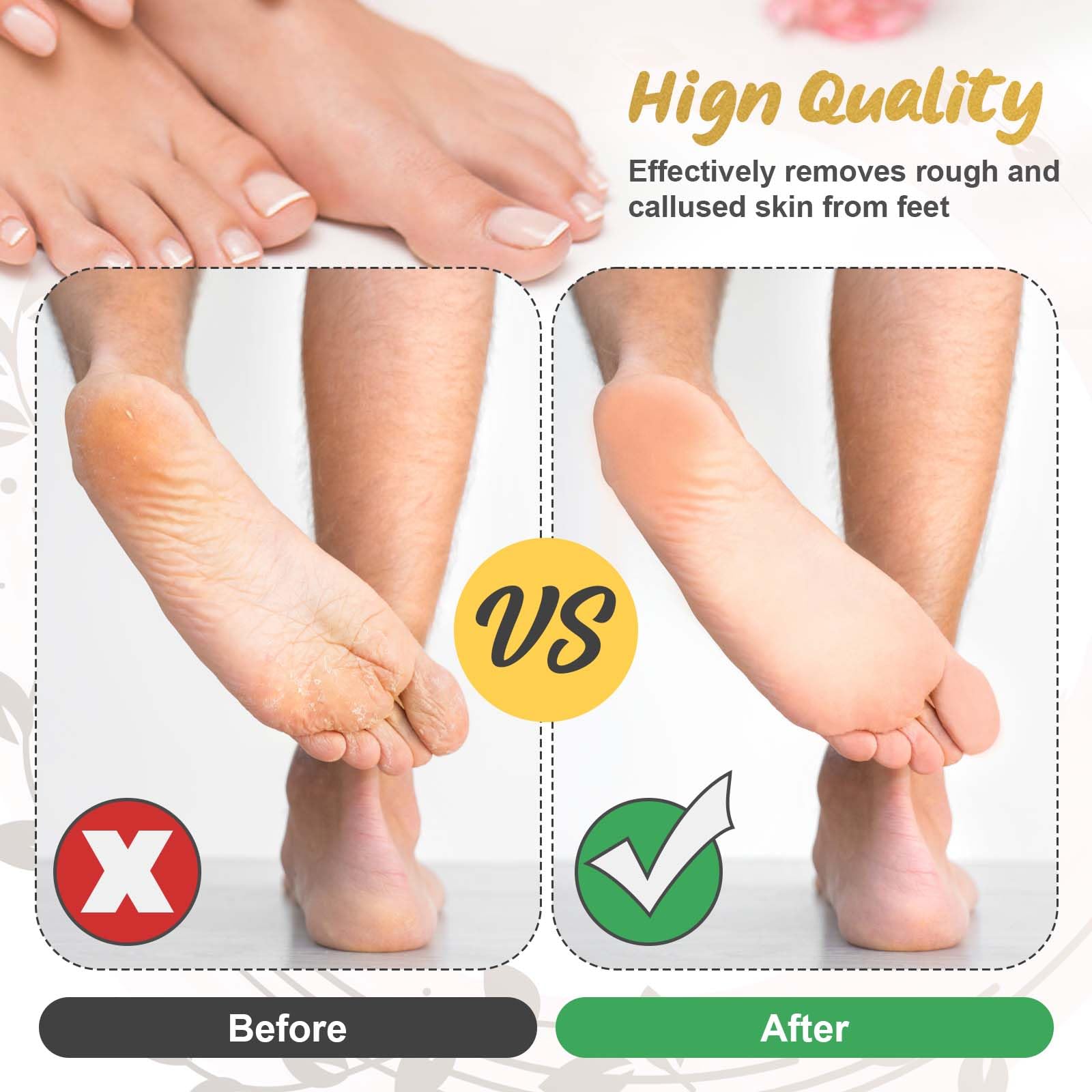 9 Pack Replacement Roller Heads for Electric Callus Remover - Extra Coarse, Regular Coarse & Fine Coarse Refills - Compatible with Most Electric Foot Files & Callus Grinders (Perfect for Pedicures & At-Home Foot Care)