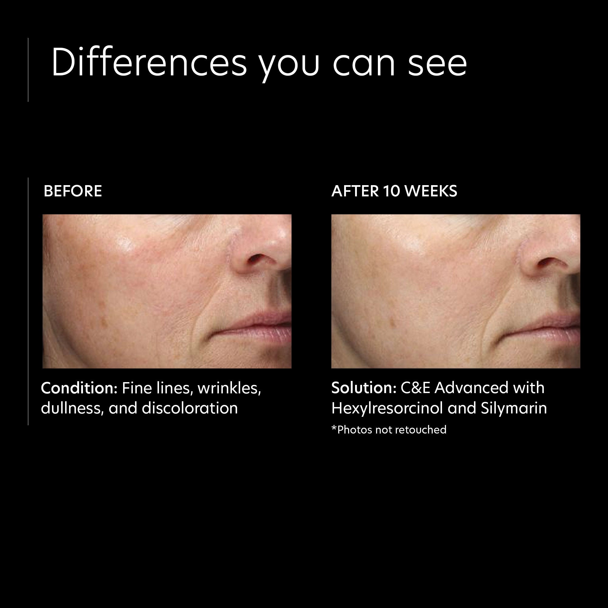 PCA Skin CE Advanced Serum - Anti-Aging Vitamin C Facial Treatment for Brightening & Wrinkles - Perfect for Daily Skincare Routine & Nighttime Repair