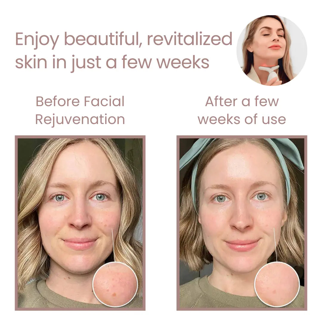 Best Facial Rejuvenation Device for Anti-Aging & Skin Tightening - At-Home Skincare Treatment for Wrinkles & Fine Lines | Perfect for Daily Beauty Routine & Spa Nights