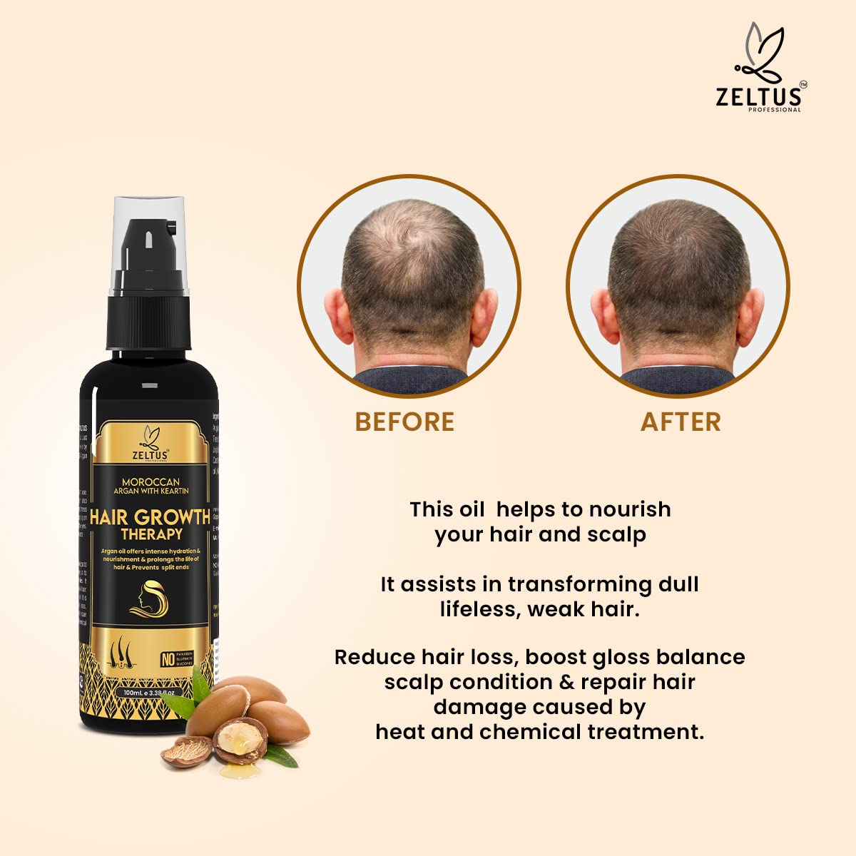 ZELTUS Hair Growth Therapy with Moroccan Argan Oil & Keratin - 100ml for Thicker Hair & Reduced Hair Fall | Natural Hair Regrowth Treatment for Men & Women | Perfect for Daily Use at Home or Salon
