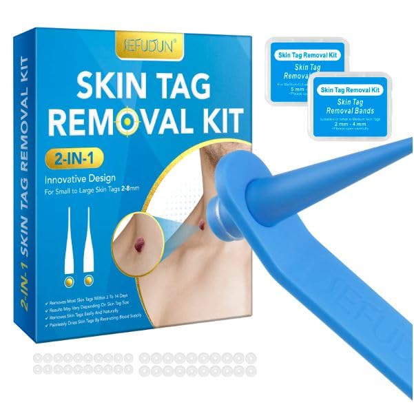 Professional Skin Tag Remover Kit - Safe & Effective Mole & Wart Removal Tool for Small to Medium Skin Tags (Blue) | 2-in-1 Wart & Skin Tag Removal Solution | Perfect for At-Home Dermatology Care & DIY Skin Treatments