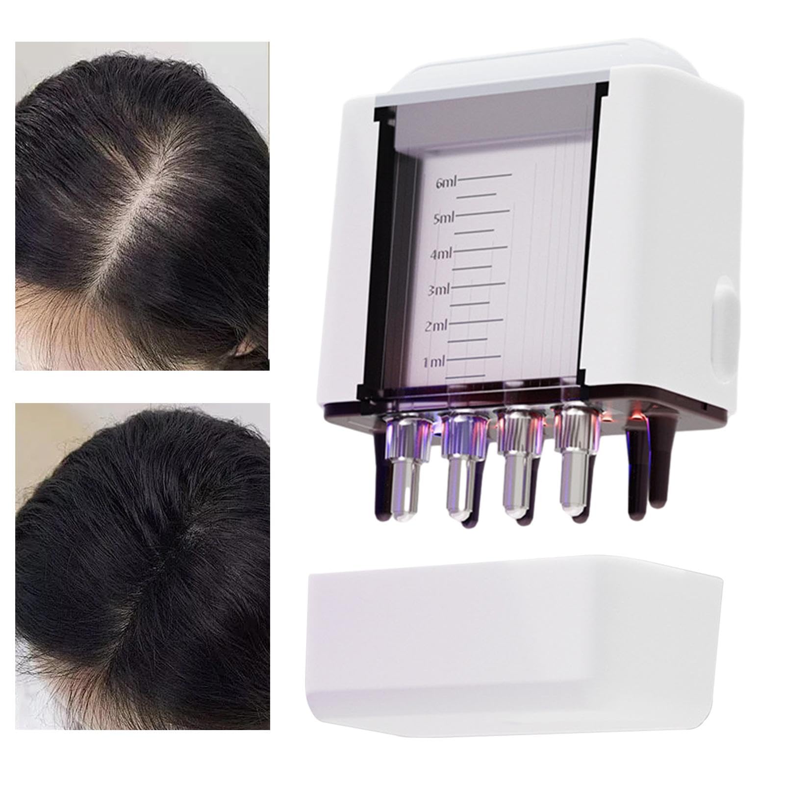 ETUCYNG Electric Scalp Oil Applicator - Hair Growth Comb with Red Light Therapy & High Frequency Vibration, Scalp Massager for Hair Care & Relaxation - Perfect for Home Spa, Salon Treatments & Daily Hair Maintenance