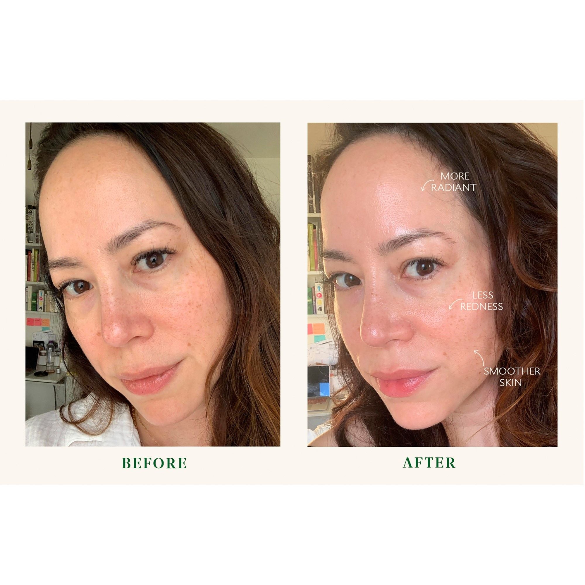 Bio Barrier Serum - Hydrating & Anti-Aging Face Serum with Hyaluronic Acid & Vitamin E - Perfect for Daily Skincare Routine & Nighttime Moisturizing