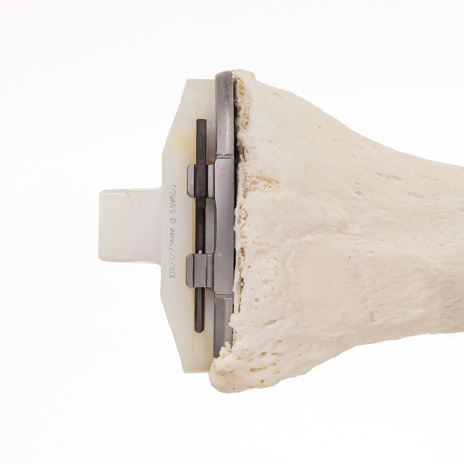 Premium Human Tibia Bone for Medical Research & Education - Ideal for Anatomy Studies, Surgical Training & Forensic Science
