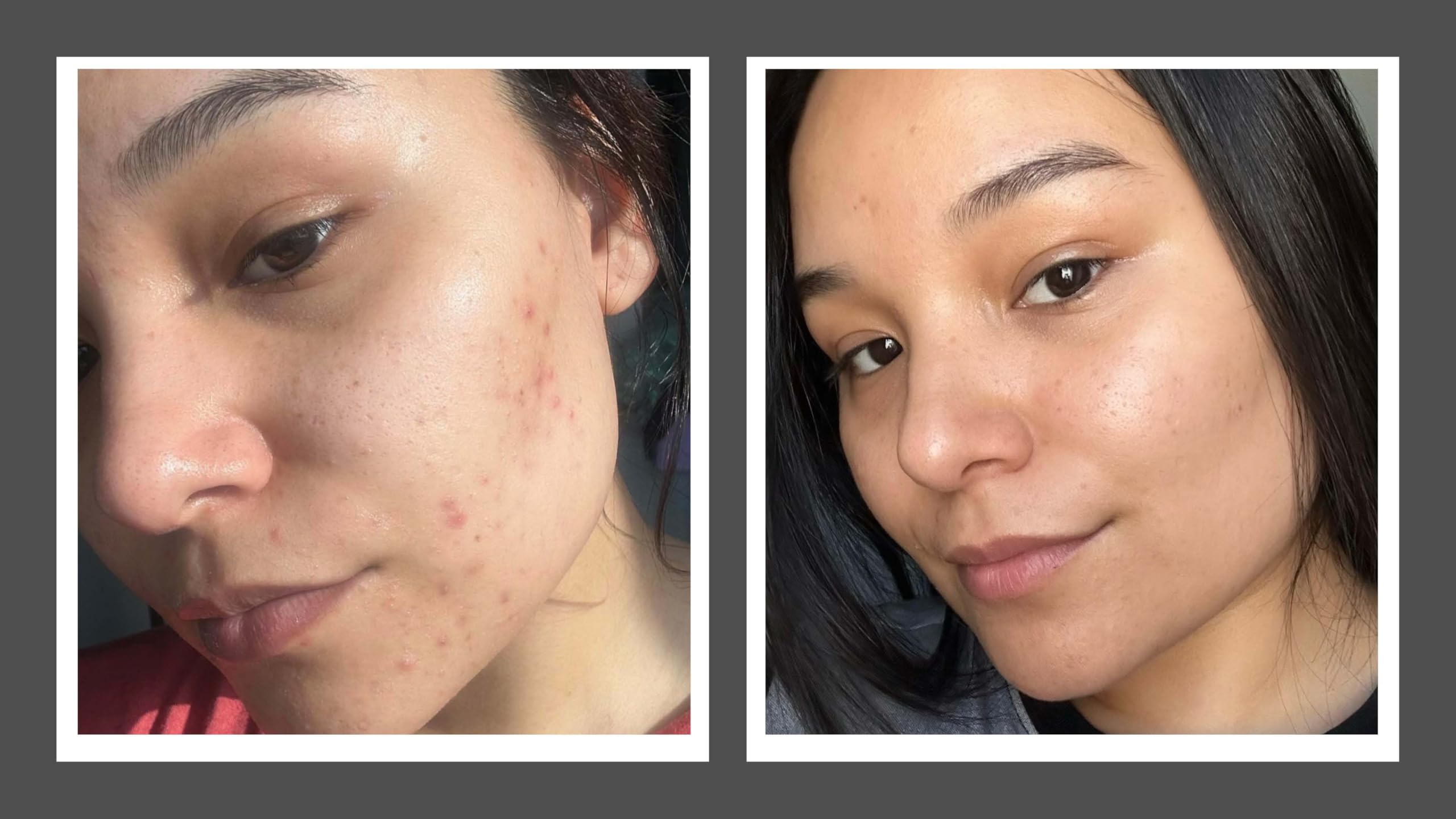 CIRCCELL - WOOSHIE'S BLEND - Organic Face Oil for Oily & Acne-Prone Skin | Hydrating & Balancing Treatment for Breakouts & Shine Control | Perfect for Daily Skincare Routine & Nighttime Use