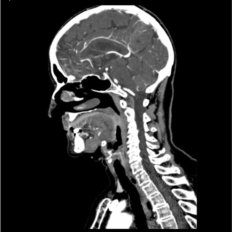 Professional CTA Head and Neck Phantom - High-Quality CT Scan & X-Ray Training Model for Medical Education | Perfect for Radiology Students, Technicians & Clinical Practice