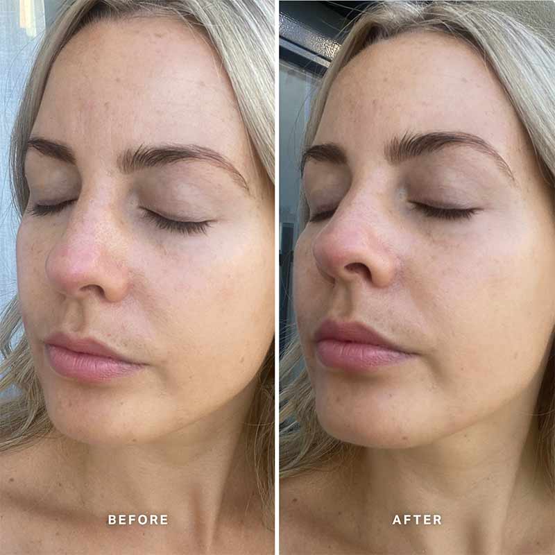 Alpha H Vitamin E Serum with 1% Ceramide Complex - Anti-Aging Face Serum for Hydration & Skin Repair - Perfect for Dry, Sensitive Skin & Nighttime Skincare Routine