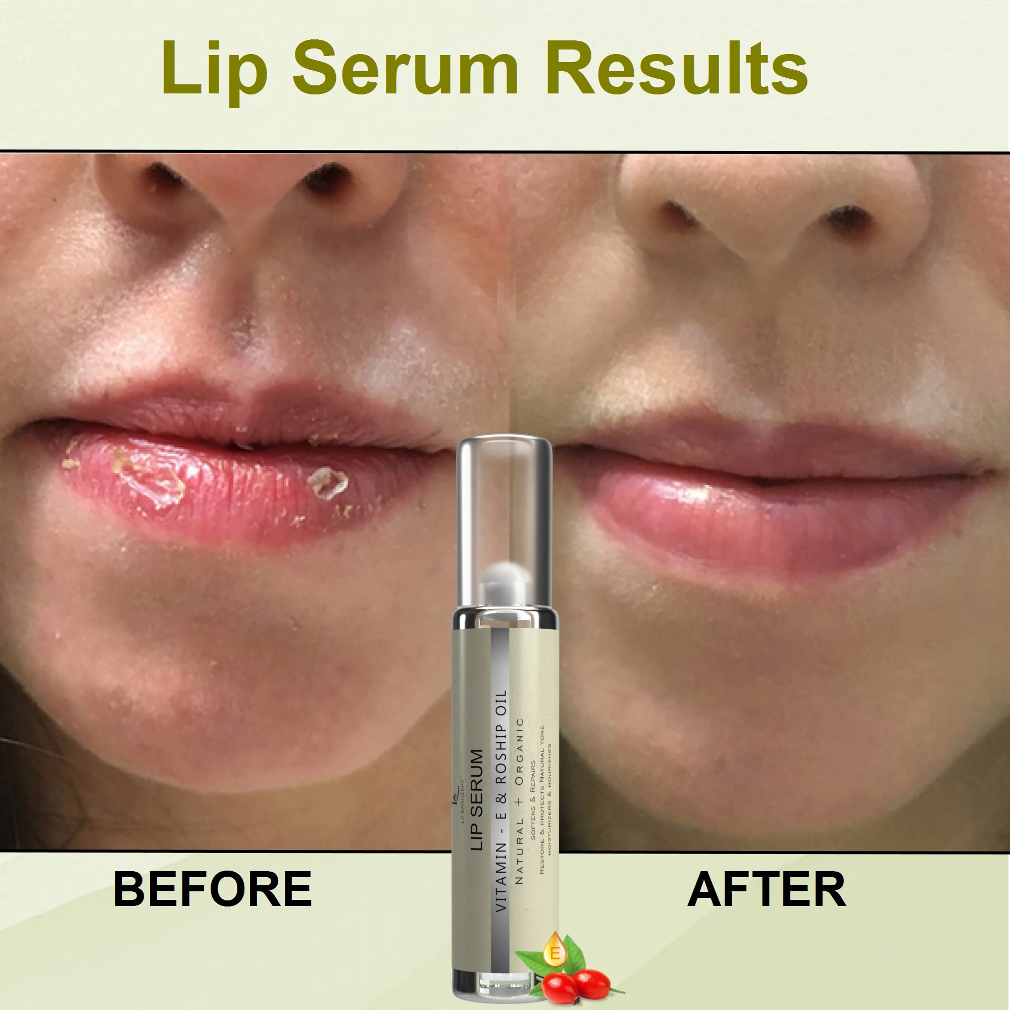 LA'BANGERRY Natural Organic Lip Serum with Vitamin E & Rosehip Oil | Roll-On Plumping Lip Treatment for Hydration & Dark Lips | 10ml Vegan Lip Care for Men & Women | Perfect for Daily Use, Night Care & Makeup Prep