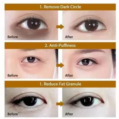 24K Gold Under Eye Masks for Dark Circles & Puffiness - Hydrating Anti-Aging Eye Treatment for Bags & Wrinkles (6 Pairs) - Perfect for Night Routine & Travel Skincare