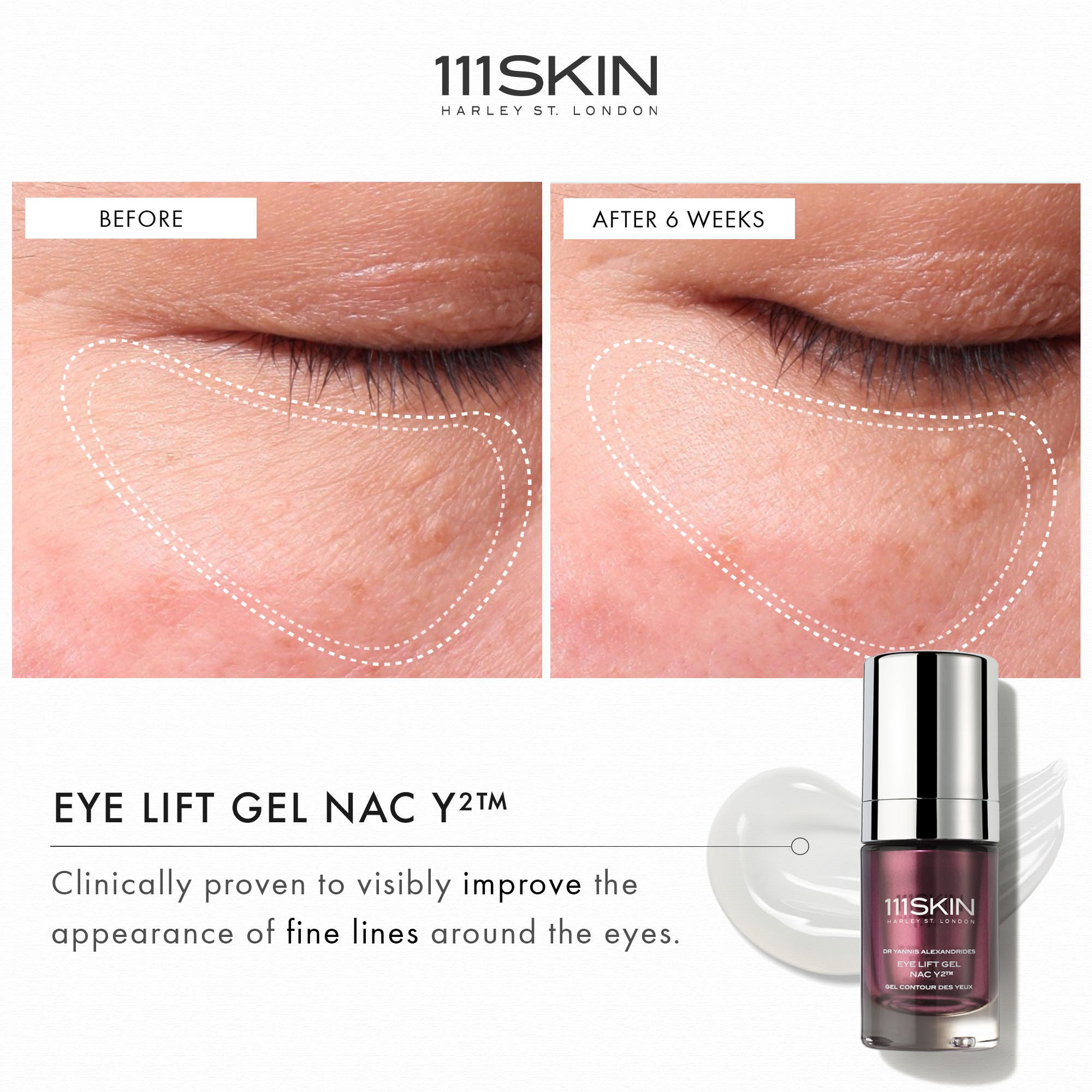 NAC Y2 Eye Lift Gel - Anti-Aging Eye Cream for Dark Circles & Puffiness - Best for Wrinkles & Fine Lines - Perfect for Morning & Night Skincare Routine