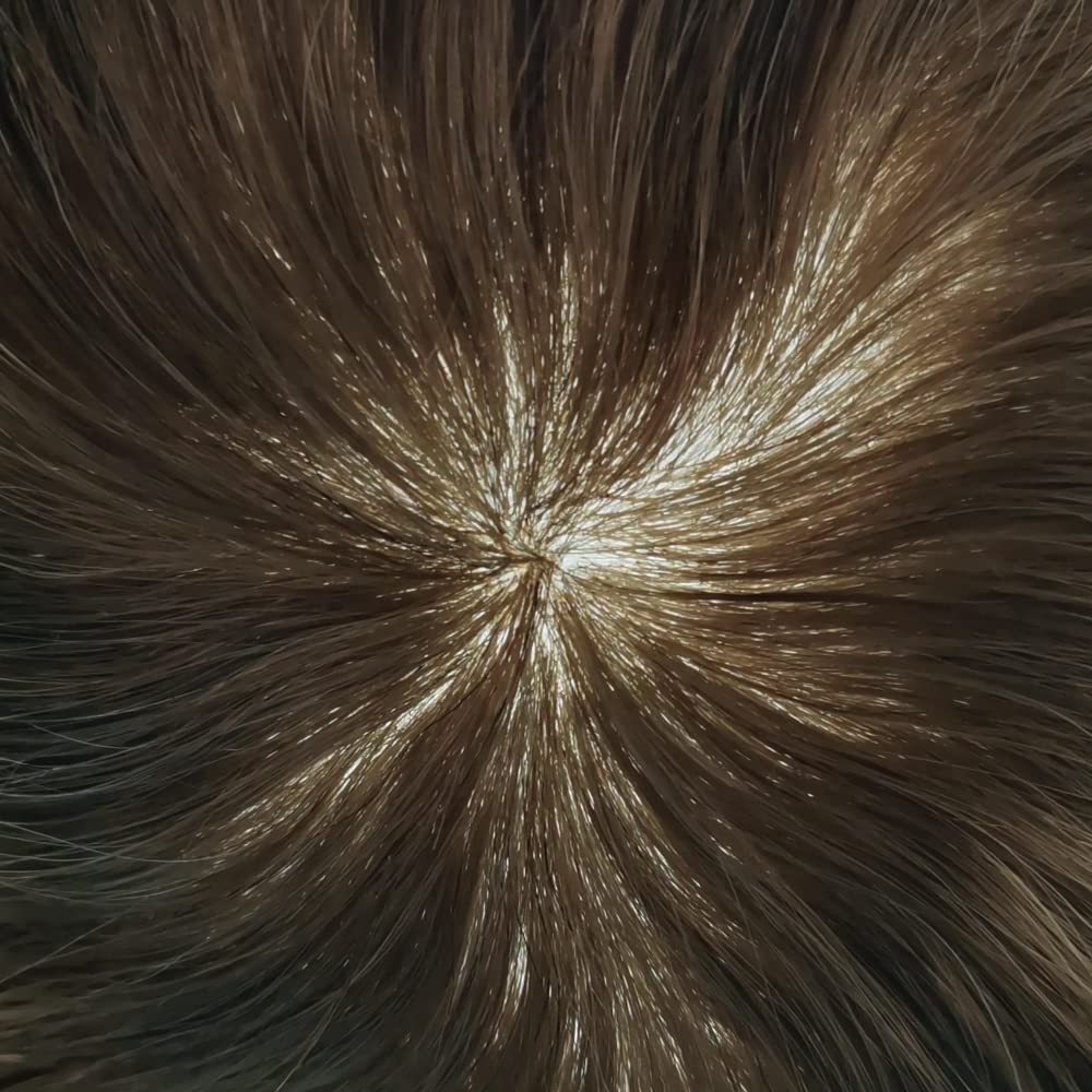 Men's Human Hair Toupee Replacement System - Thin Skin All Poly Hairpiece with Injection Skin PU - Natural Looking Wig for Male Hair Loss (#3 Dark Brown, 120% Medium Light to Medium Density) - Perfect for Daily Wear, Special Occasions & Confidence Boost