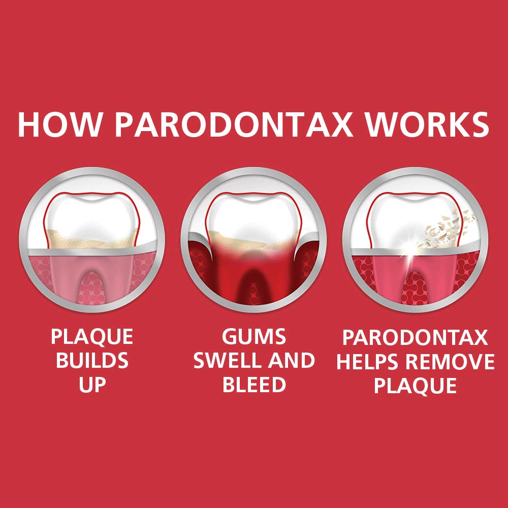Parodontax Clean Mint Toothpaste for Bleeding Gums & Gum Disease - 3.4 Oz (6 Pack) - Fresh Breath & Plaque Control - Ideal for Daily Oral Care & Sensitive Gums